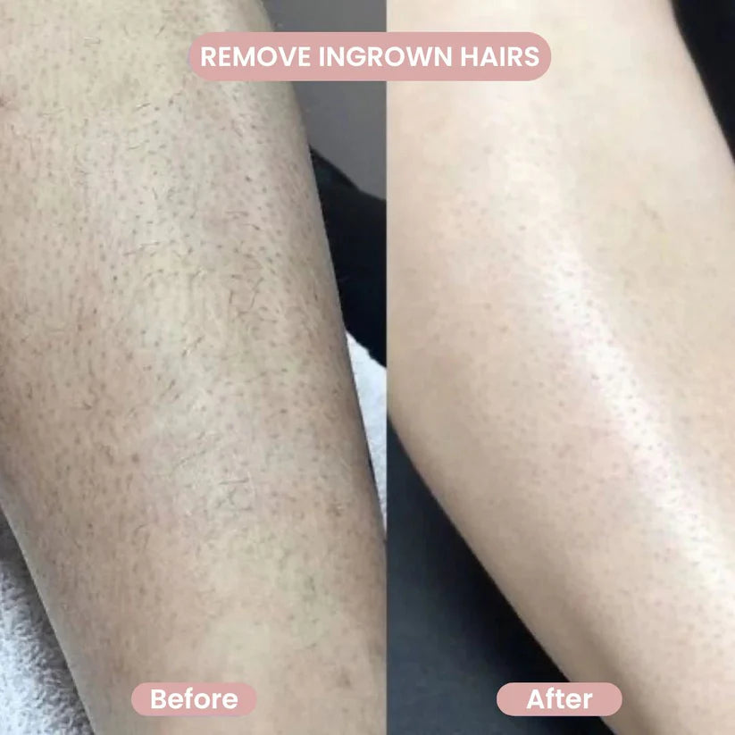 Cenvico™ Smoovi 2.0 Bikini Shaver
