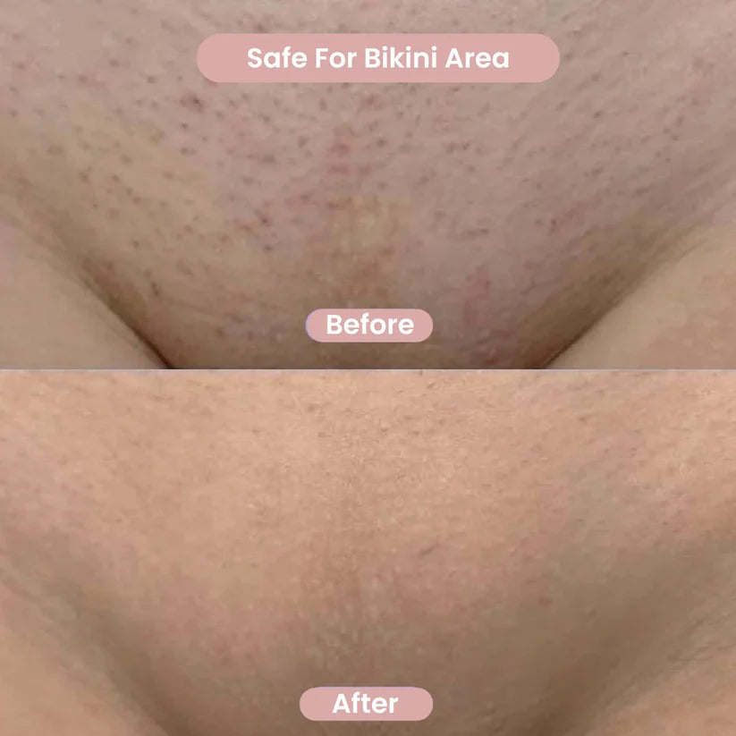 Cenvico™ Smoovi 2.0 Bikini Shaver